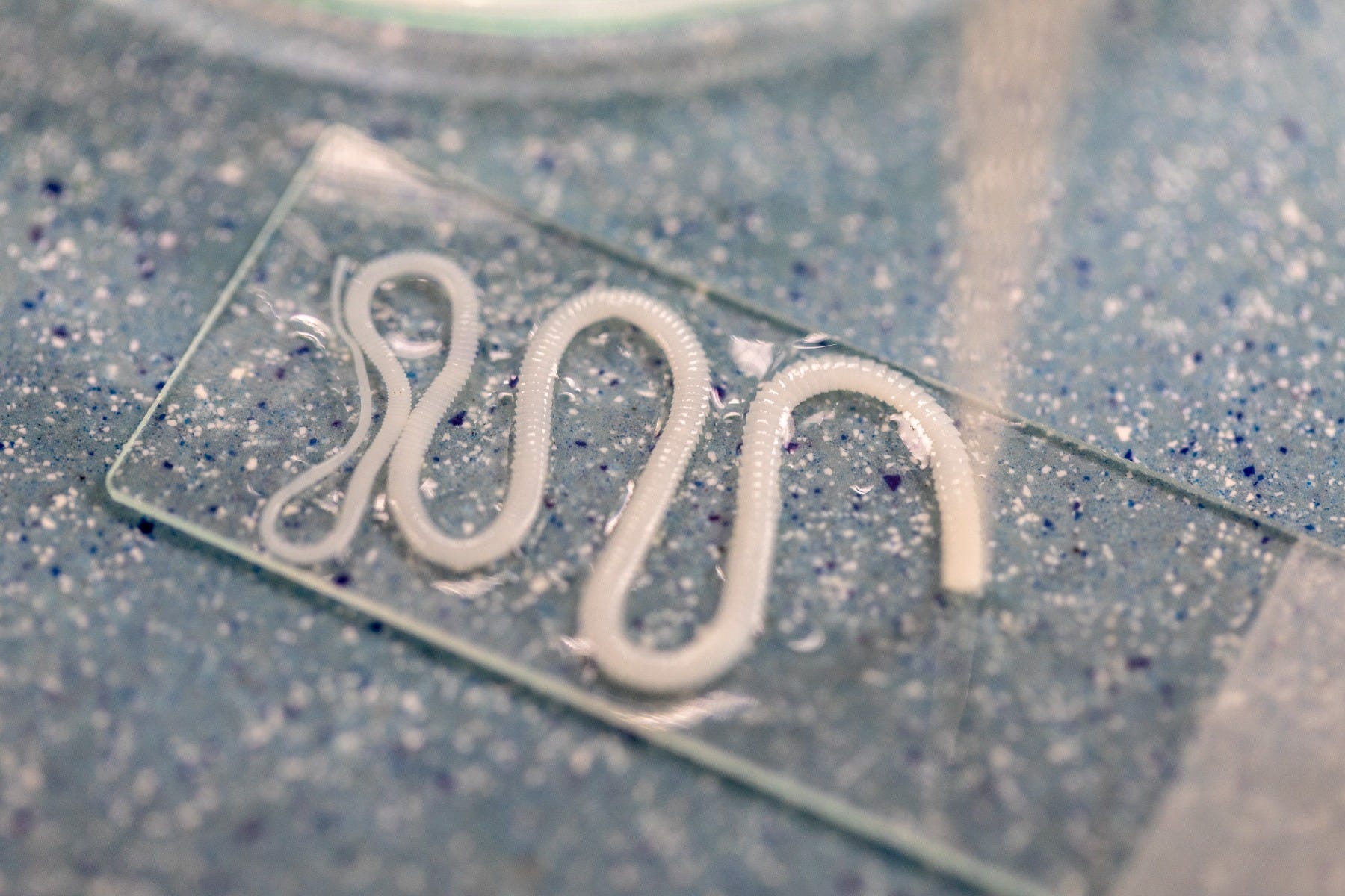 Tapeworm on a microscope slide