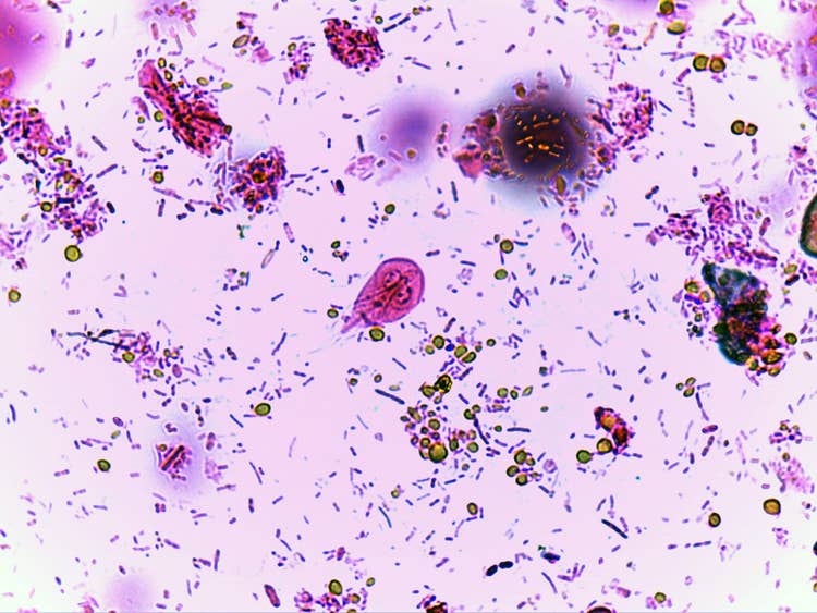 A close up image of Giardian Protazoan under a microscope