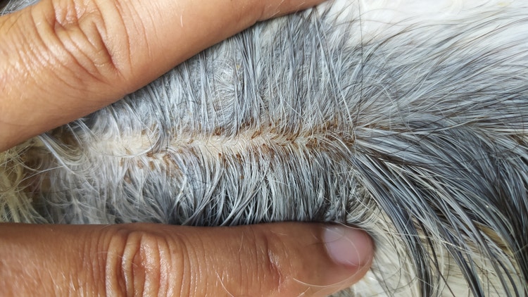 An owner parting their horses hair to reveal lice